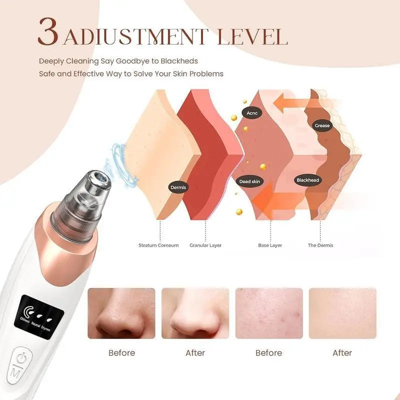 Using GlowLift pore vacuum on nose to lift blackheads and buildup